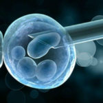 preimplantation-genetic-screening-cgh1